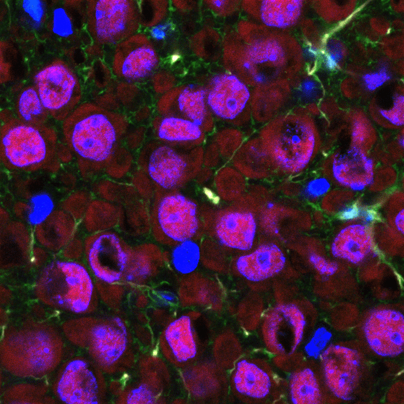 An image of a brain slice with neurons and glial cells visible in stain